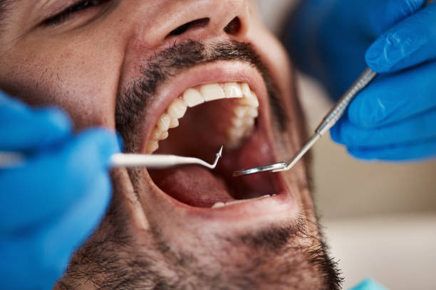 Best Emergency Broken Tooth Repair in Clarksville, TX